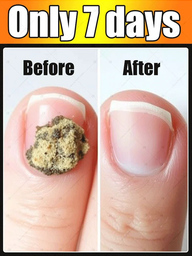 

Hot sales products improve manicure for bad Can in 7 days farewell