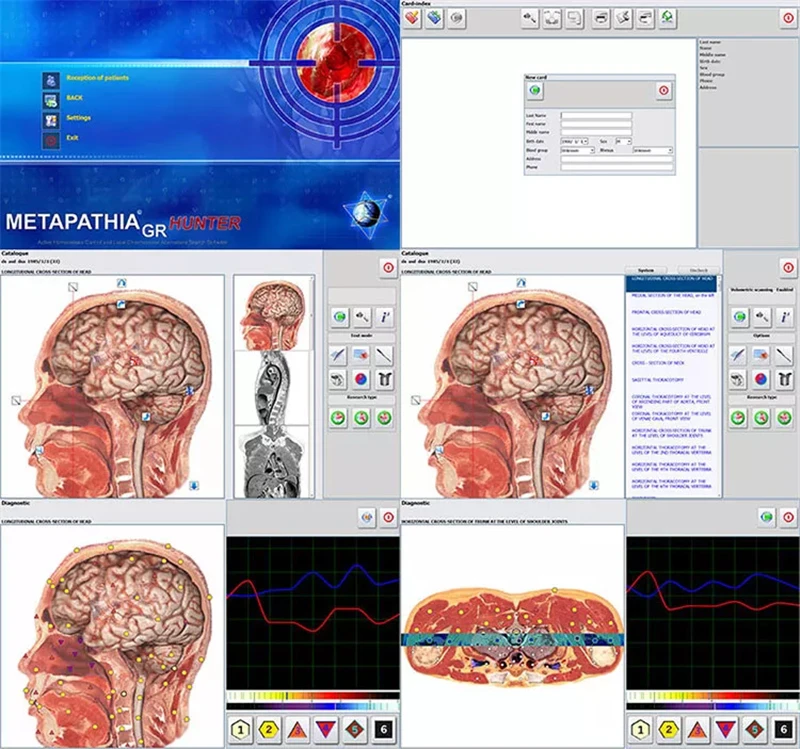 Hunter 4025 Bioresonance NLS Meta-pathia NonLinear Etalons System Health Analyzer Therapy Machine Body Scan Device Auto Therapy
