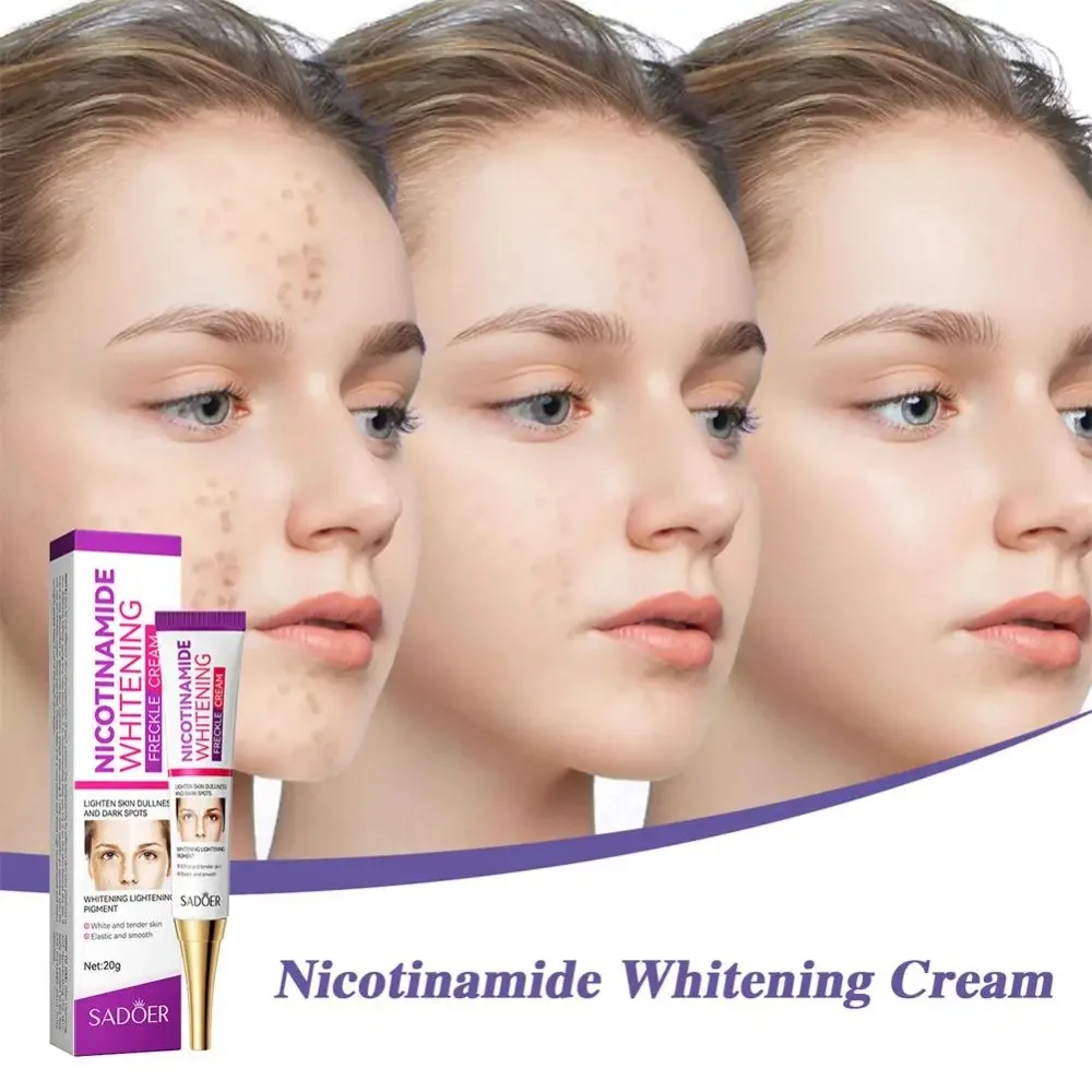 Nicotinamide Whitening Cream Brightening Fade Color Spots Freckles Cream Skin Hydration Remove Melasma Moisturize Cream Women