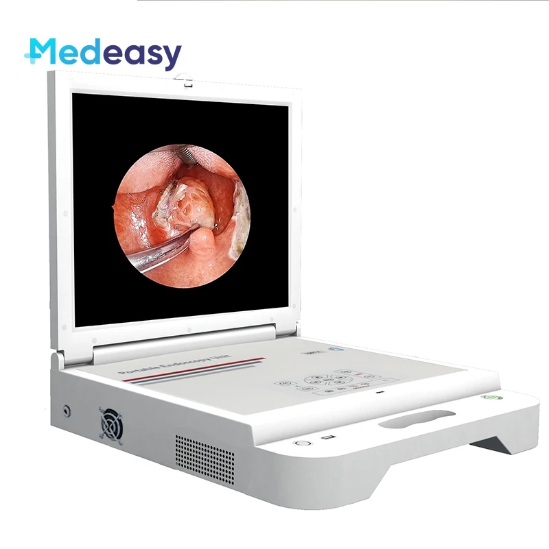 Portable Endoscope Camera with Monitor, Led Light Source & HD Recorder, Medical Portable Endoscopy Camera Unit