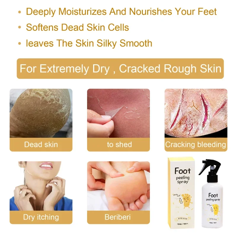 Foot exfoliating repair brightening spray Anti-Drying Crack peeling Treatment Removal Dead Skin calluses feet whiten care liquid