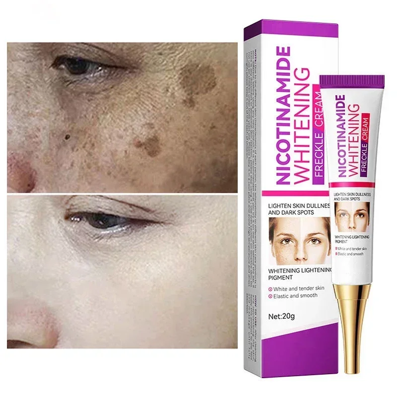 Melasma Remover Cream Removal Dark Pigment Brighten Cream Face Fade Melanin Cream Nicotinamide Brightening Moisturizing Emulsion