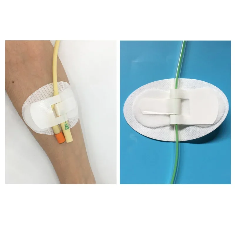 

20/10/3pc non-woven adhesive holder foley catheter holder homecare fixed stick catheter care sterilized fixed tube size11*6cm 5.