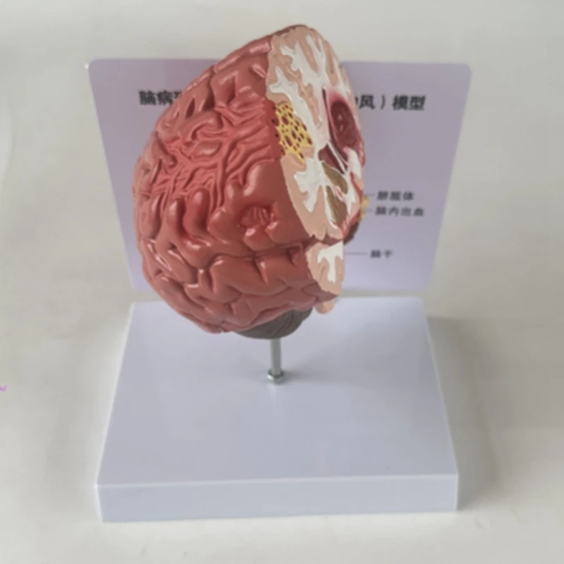 نموذج أمراض الدماغ البشري ، تدريس أمراض الدماغ ، نموذج تشريح الدماغ