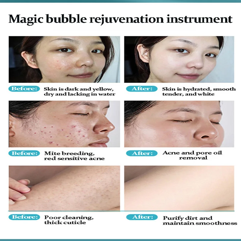 Magic Bubble Machine para limpeza facial SPA, gerenciamento de pele, salão de beleza, instrumento de beleza multifuncional, ferramentas japonesas