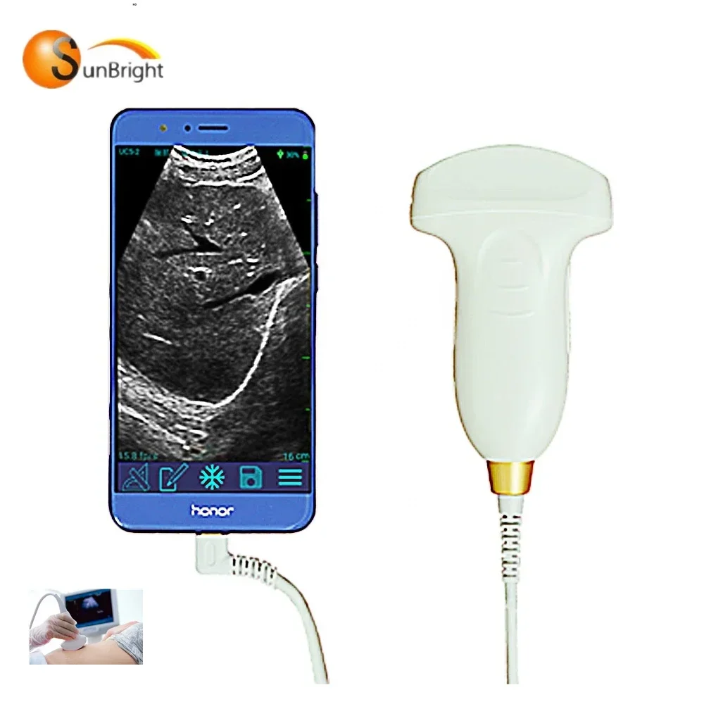 Promotion For Android Connect Wireless Ultrasound Machine Convex Probe Wireless USG