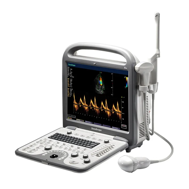 Sonoscape S8 Portable Color ultrasound scanner cardiac ultrasound machine