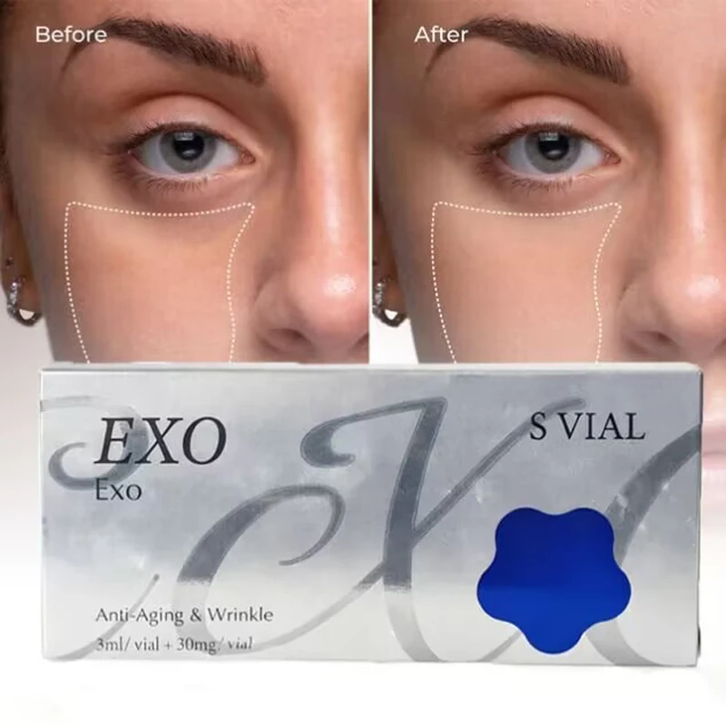 12 Vials/Box EXO-Glow Collagen Exossomes Facial Serum For Dermapen Skin Care Anti-Aging Korean Healthier Facial Essence Ampoule