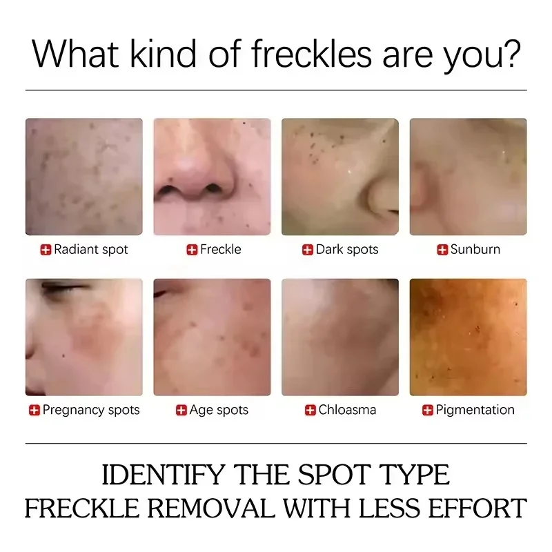 Dark Spots Removal Cream Facial Whitening Freckle Acne Mark Pigmentation Removal Melanin Skin Correction Brighten Care Products - Image 4