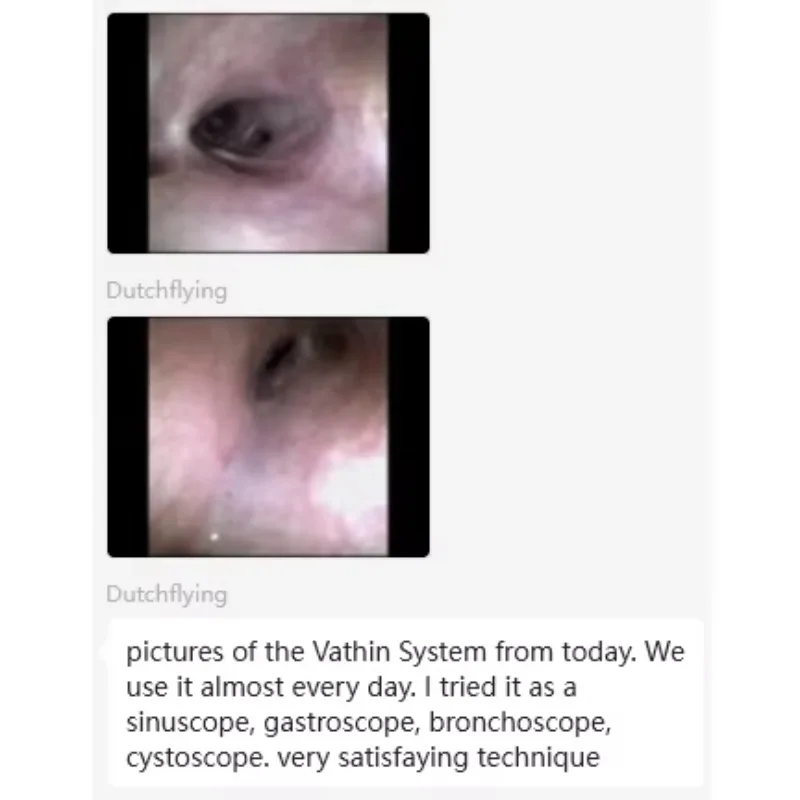 Flexible Single-use Veterinary Bronchoscope Disposable Endoscope for Pet Clinical Respiratory Inspection