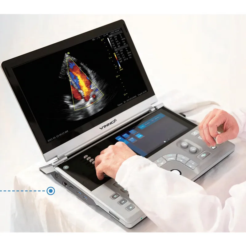 VINNO 6 Medical Ultrasound ultrasonic Instruments, Portable Color Doppler 4D Ultrasound Machine