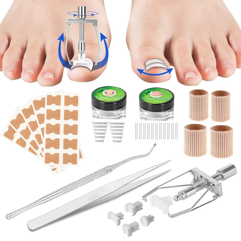 1 conjunto de adesivos de correção de unhas, tiras de correção de unhas encravadas à prova d'água, anti-infecção, corretor de pés, pedicure, ferramenta de saúde
