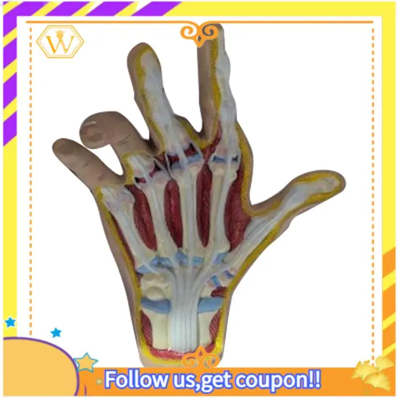 

Latest-Osteoarthritis Hand Model, Model Of Hand Pathology, Human Anatomy And Physiology Replica, 's Office Anatomy Model