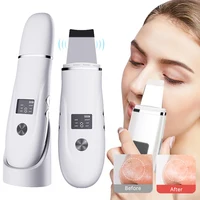 Depurador Facial ultrasónico, máquina peladora Facial, puntos negros, eliminador de espinillas, acné, poros, limpieza profunda, depurador ultrasónico de la piel