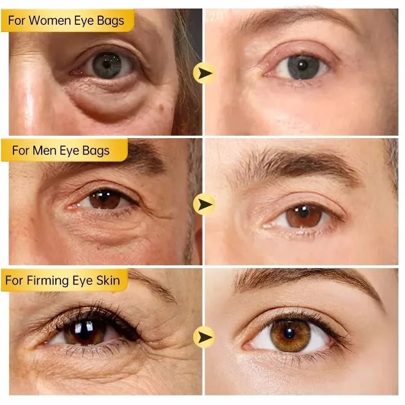 Retinol Eye Serum Fades Fine Lines Remove Dark Circles Eye Bags Puffiness Anti-Aging Moisturizing Brighten Man Woman Eye Care