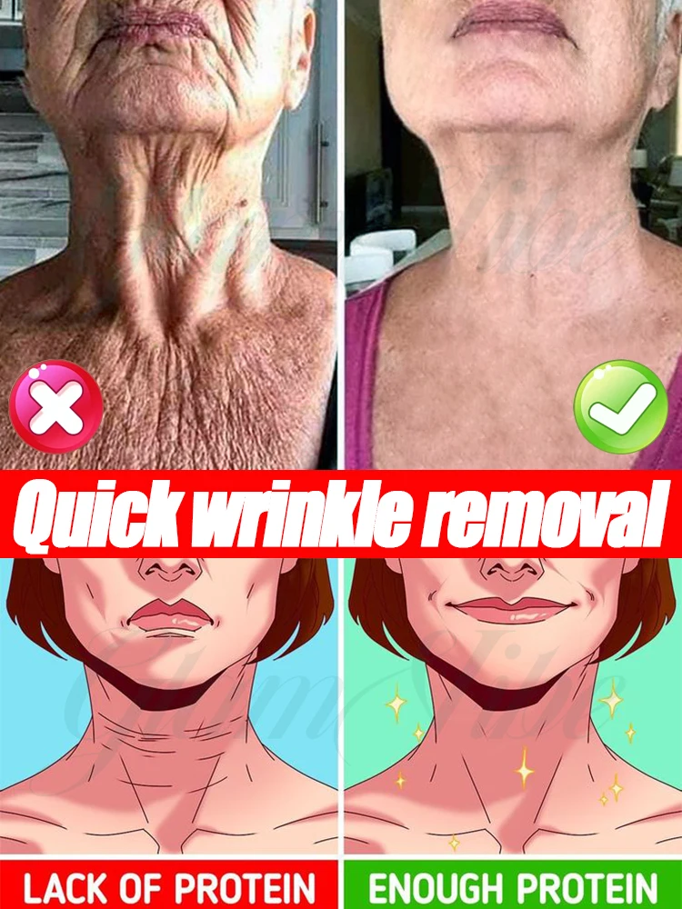 

Быстро устраняет морщины на шее Абсолютно эффективно