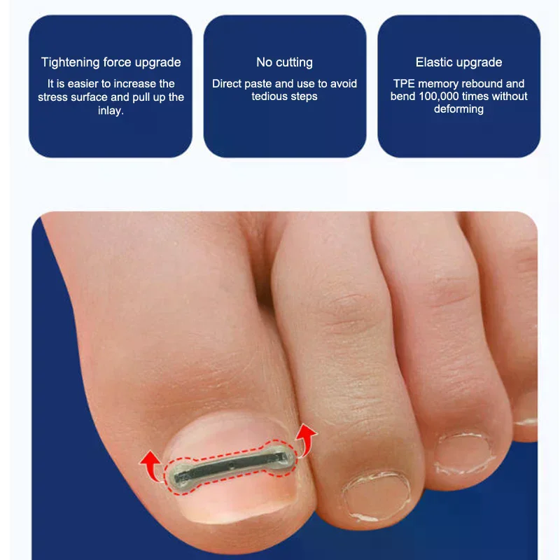 Kit de traitement des ongles incarnés, 12 pièces, avec 4 tailles multiples, outils correcteurs d'ongles incarnés en alliage de titane pour correcteur d'ongles incurvés