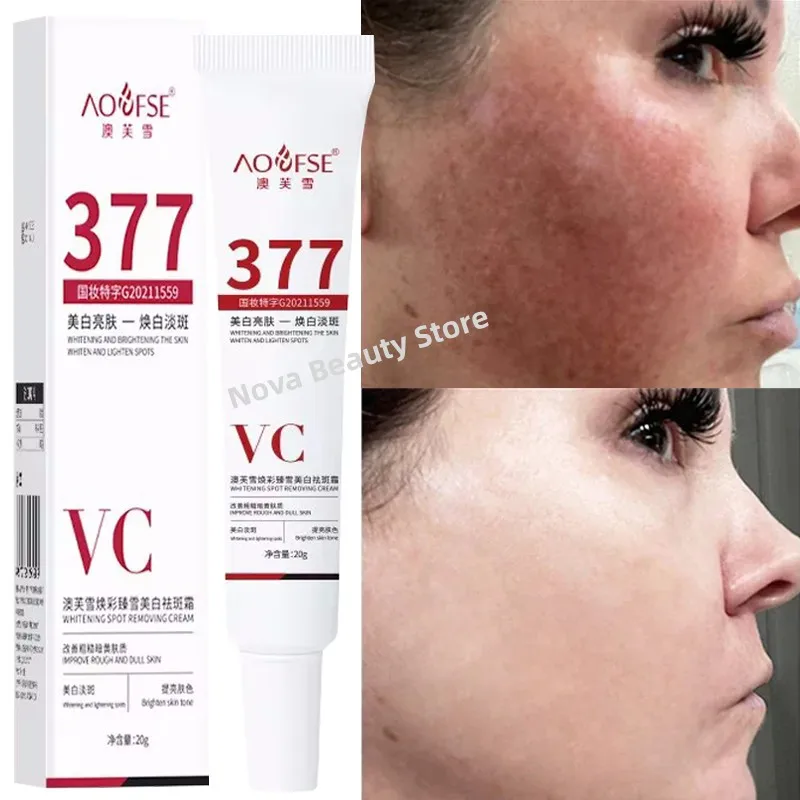 

Niacinamide Melasma Brightening Cream Reduce Melanin Brighten Cream Lighten Dark Skin Chloasma Repair Serum Face Care Products