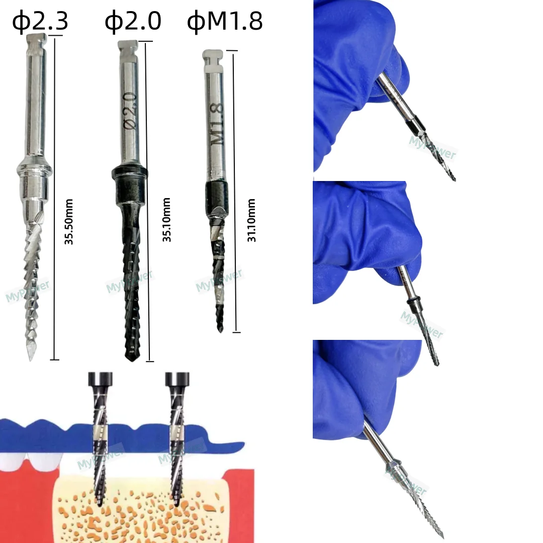 Perceuse Dentaire à Croix pour Implant, Sophia Cut Debri Blade Fit Lindemann Osstem 2.3/2.0/M1.8