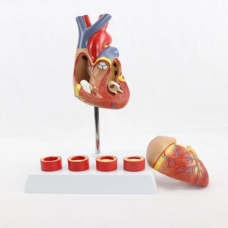 Medical Simulation Removable Anatomical Life Size Heart Cardiovascular Anatomy Thrombotic Vascular Model Teaching Supplies