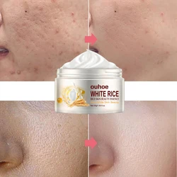 Creme Facial Anti-Rugas para Acne, Tratamento de Melasma, Pigmentação Clareamento, Face Lifting, Beleza Hidratante, Cosméticos Coreanos, 30g