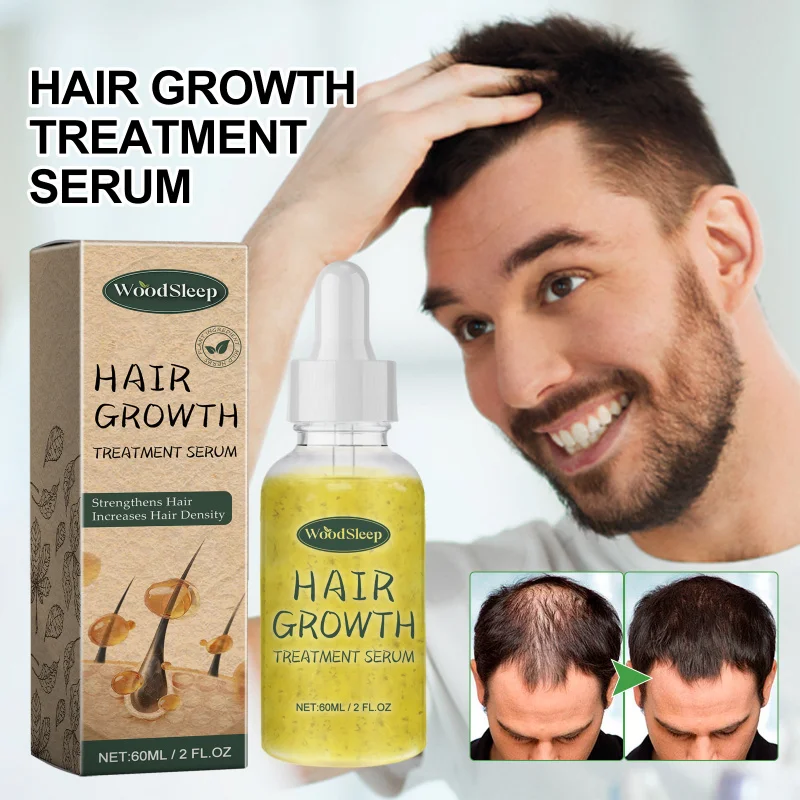 

Hair Strengthening Oil For Damaged Hair, Nourishing Treatment To Support Thicker-Looking Hair Scalp Health, Lightweight Formula