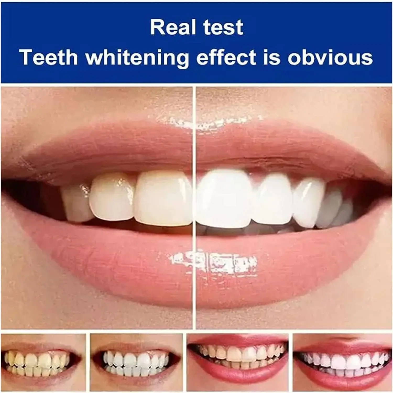 SP-7 Probiotic Toothpaste,Super Probiotic Toothpaste,Sp7 Toothpaste,Deep Cleaning Toothpaste,Fresh Breath Toothpaste