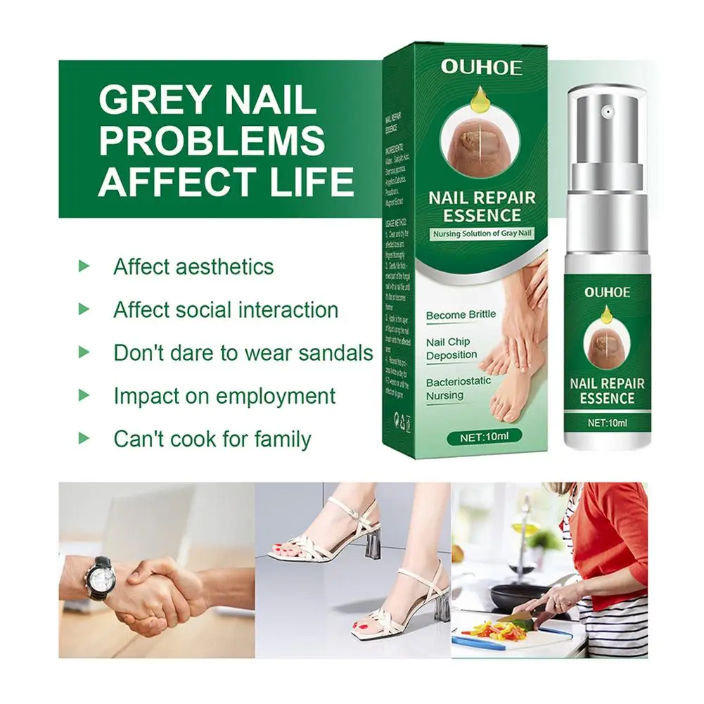 Multifunctionele Nagelreparatie, Teennagelreparatie Essentie, Nagels Beschermen Tegen Beschadiging, Voor Het Repareren Van Verkleurde En Beschadigde Nagels 10Ml