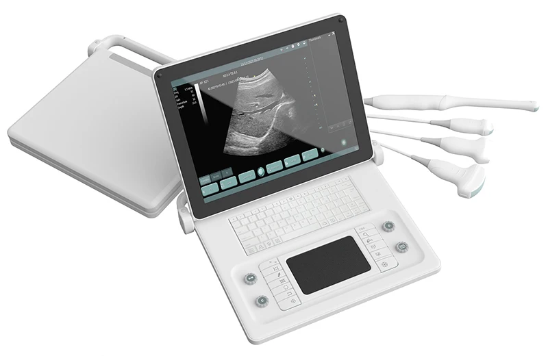 SS-8B B/W Laptop ultrasound System