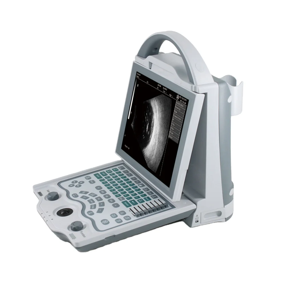 ODU5 Full Digital A…