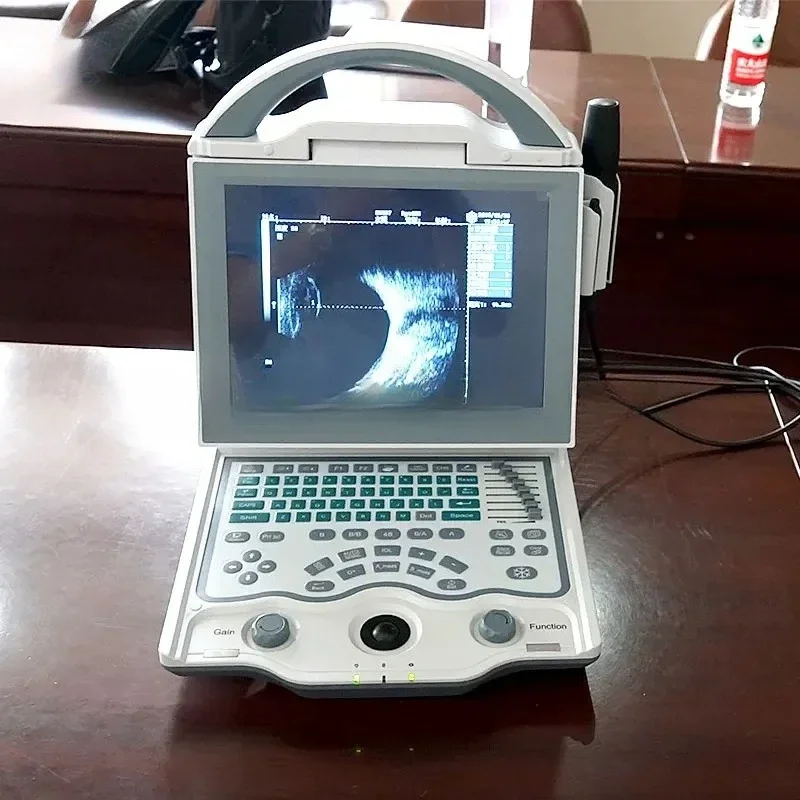 US101 Cheap Eye Scanner Portable Full Digital A/B Ophthalmic Ultrasound Equipment Price