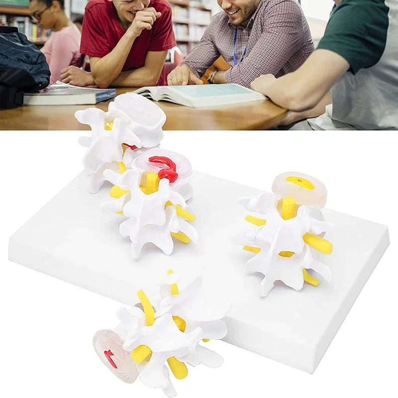 Human Anatomy Skeleton Spine 4-Stage Lumbar Vertebra Model Brain Skull Traumatic Medical Teaching Supplies