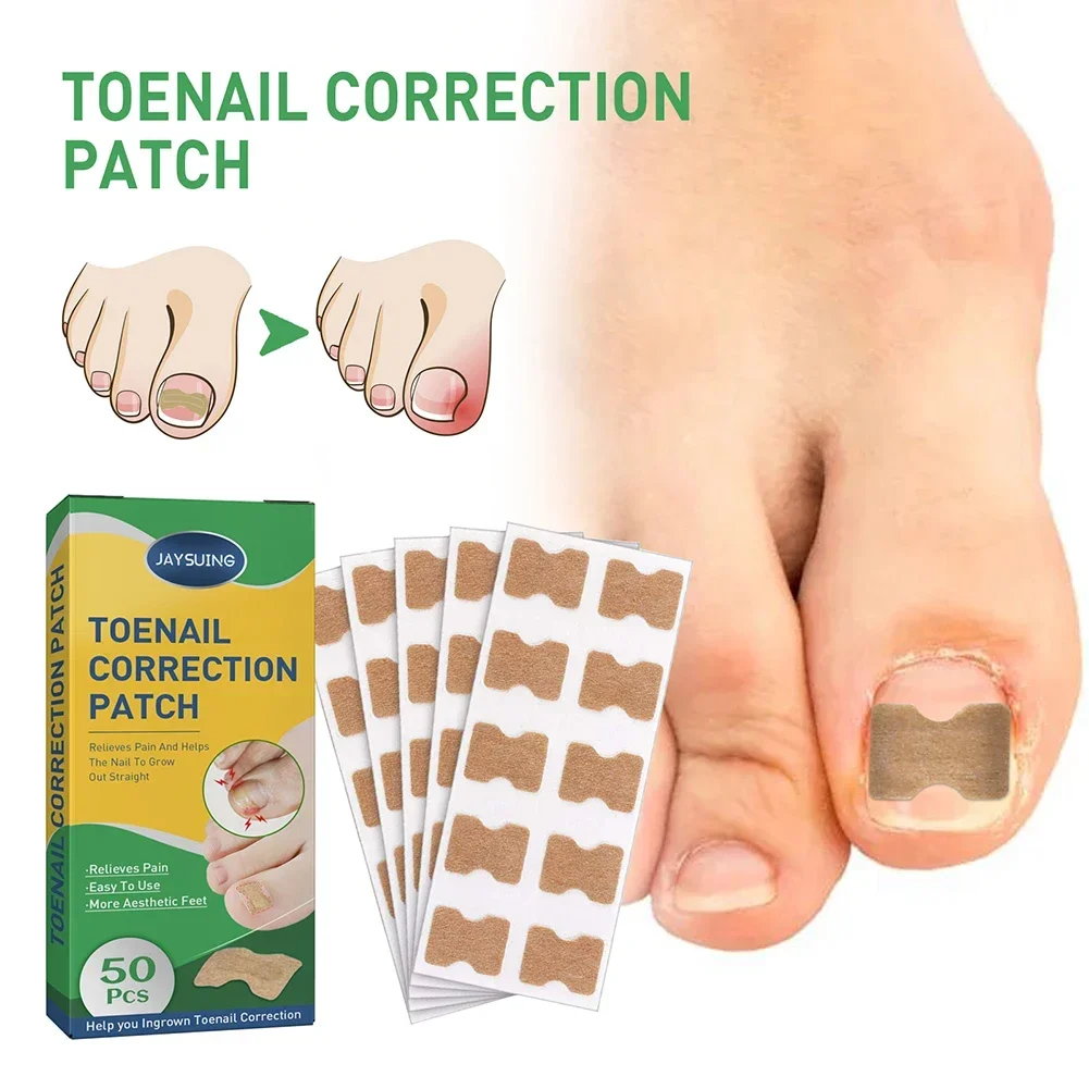 Uñas Ingrown Toenail Sticker Invisible Nail Correction Sticker Ingrown Toenail Corrector Strips Recover Corrector Pedicure Tool