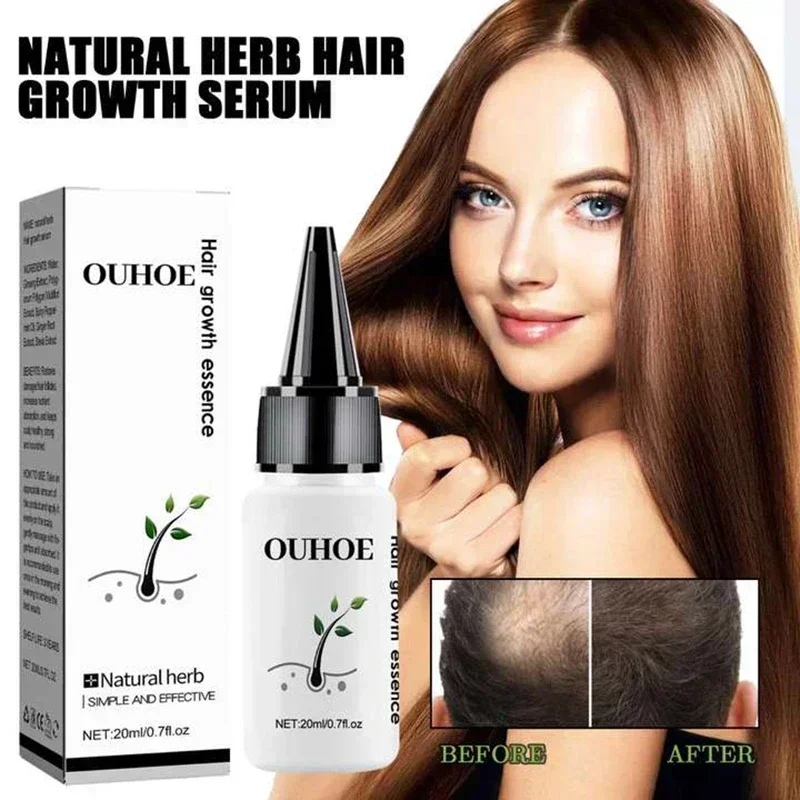 Fast Hair Growth Oil Baldness Repair Hereditary Hair Loss Postpartum HHair Loss Seborrheic Hair Loss Oil Fast