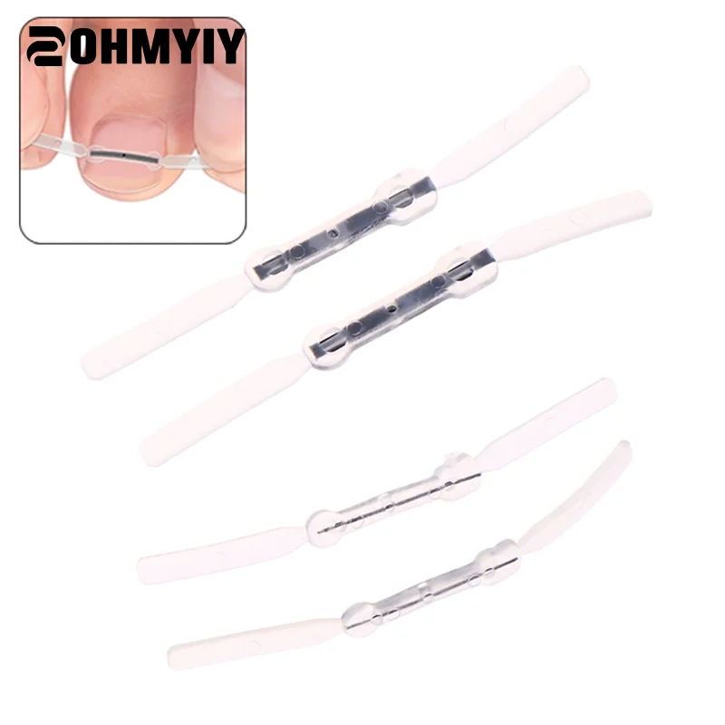 4 ピース/セット陥入爪矯正ツール陥入爪治療弾性パッチステッカー矯正クリップブレースペディキュアツール