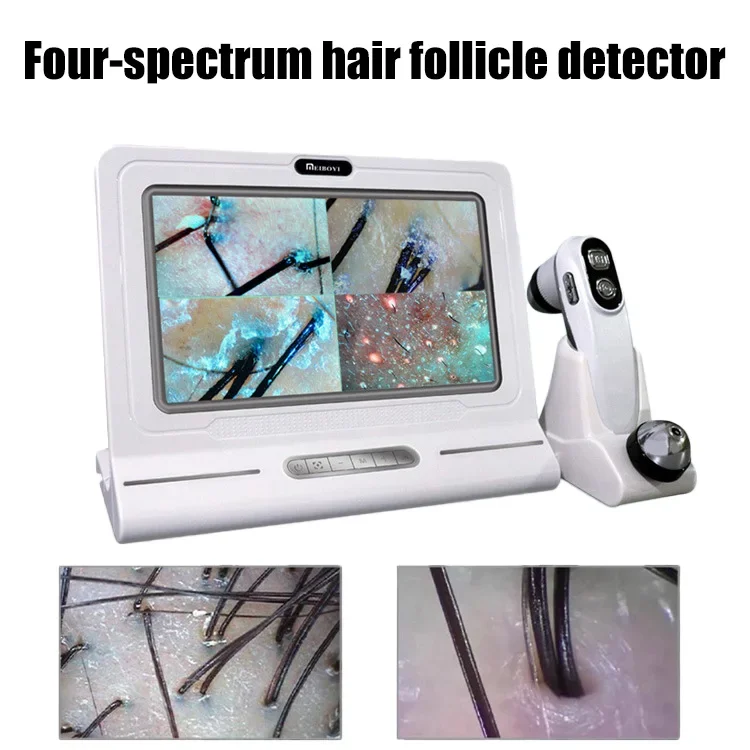 HD digital microscope hair follicle detector scalp hair analyzer for scalp follicle skin test