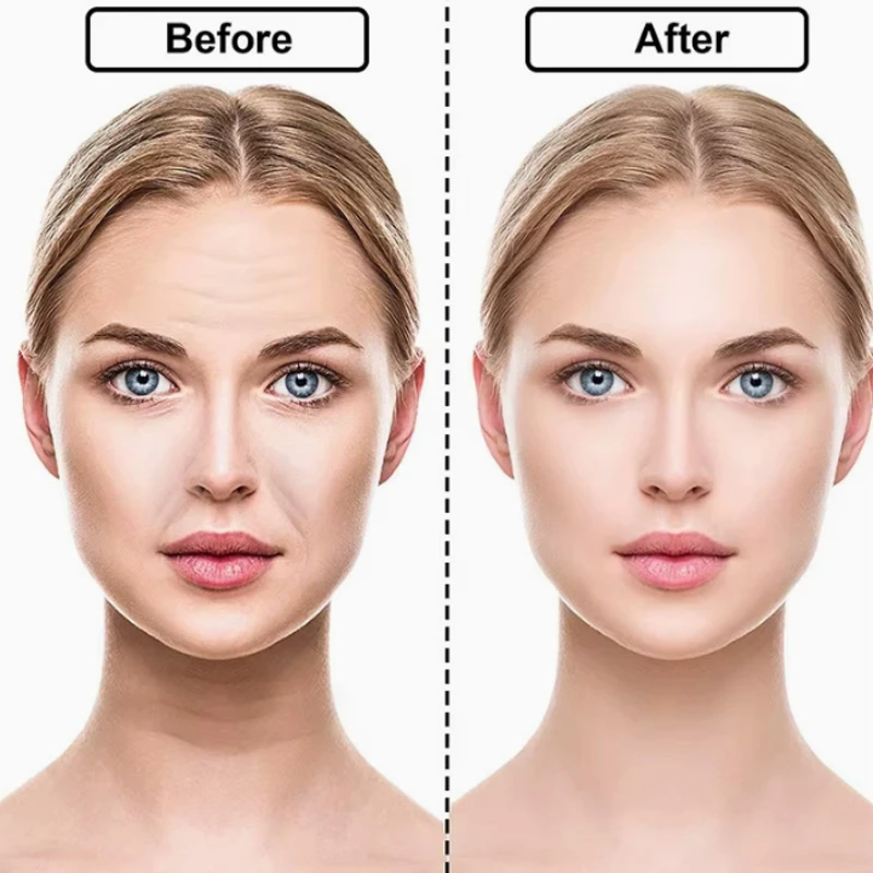 16pcs/set Reusable Silicone Patches Anti Rimpel Pads Wrinkle Removal Sticker Face Forehead Neck Eye Stickers Skin Care Patches