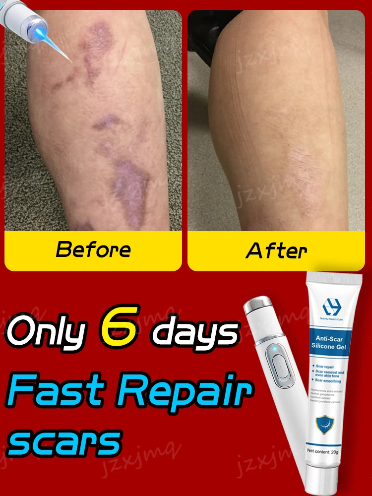 

Blue Light Laser Skin Repair Scars Hot Selling