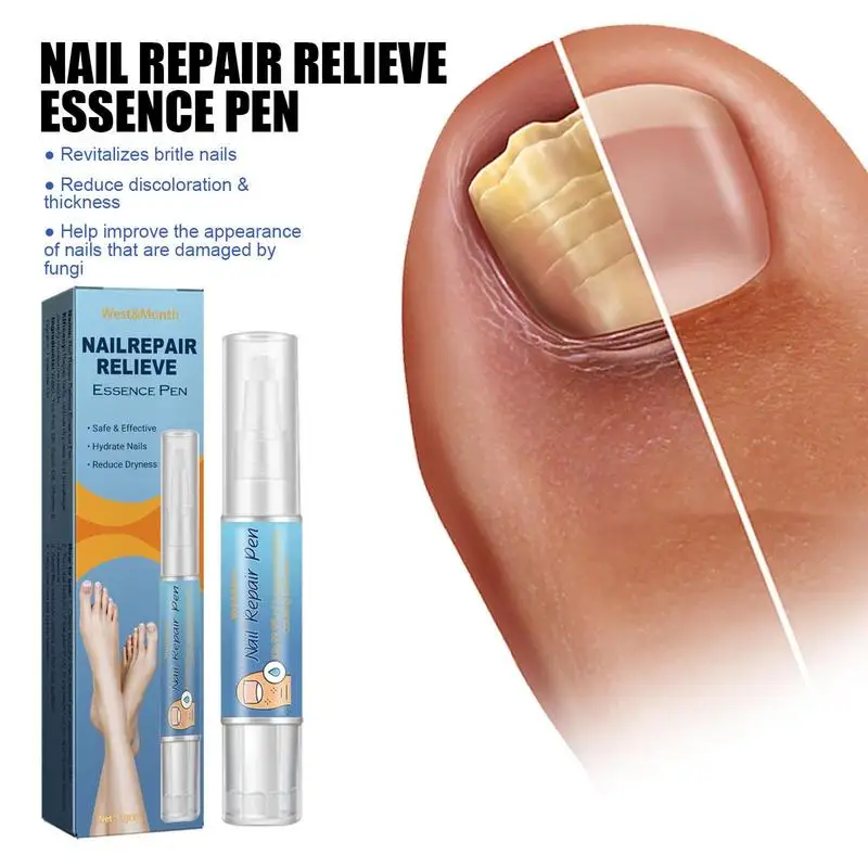 Portátil Toe Nail Tratamento Pen, Renovação unha, Reparação Eficaz, Cracking descolorido