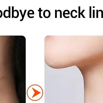 الحرارة EMS الوجه الرقبة مدلك أيون LED الفوتون العلاج الوجه رفع أجهزة التجميل إزالة الذقن المزدوجة المضادة للتجاعيد أدوات العناية بالبشرة