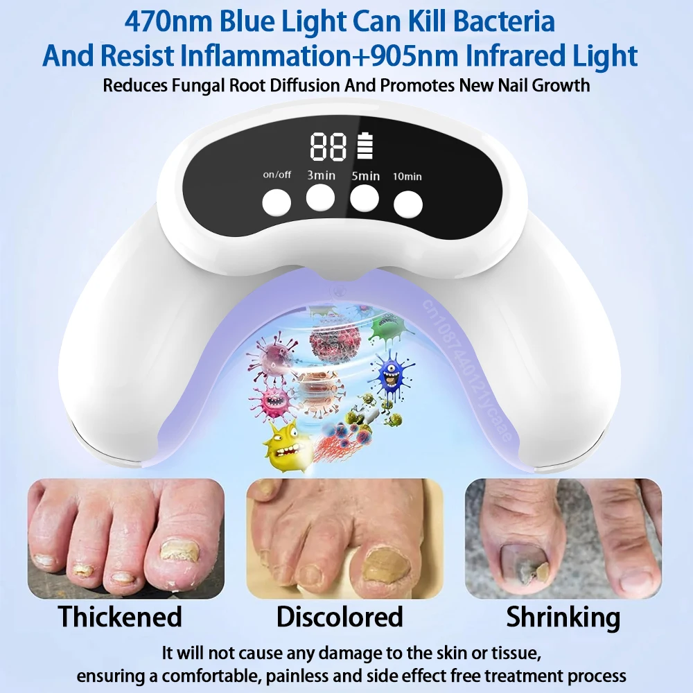 Nail Fungus Cleaning Laser Device For Multiple Toenail Repair Fast Nails Fungus Onychomycosis Removes Ingrown Toenail Treatment