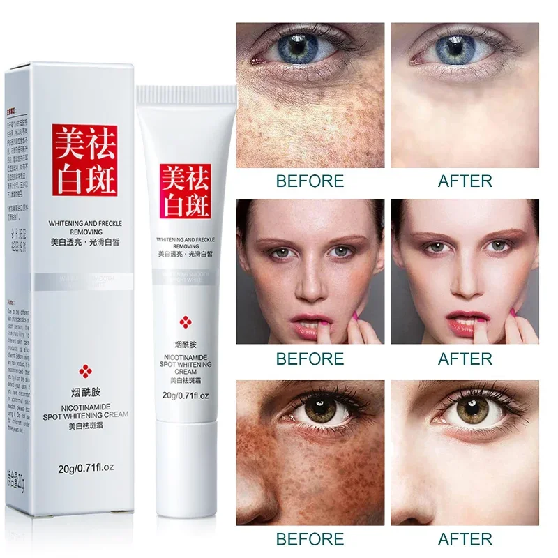 Improve Freckle Whiten Cream Effective Dullness Remove Dark Spot Melasma Fade Anti-pigmentation Brighten Face Skin Care