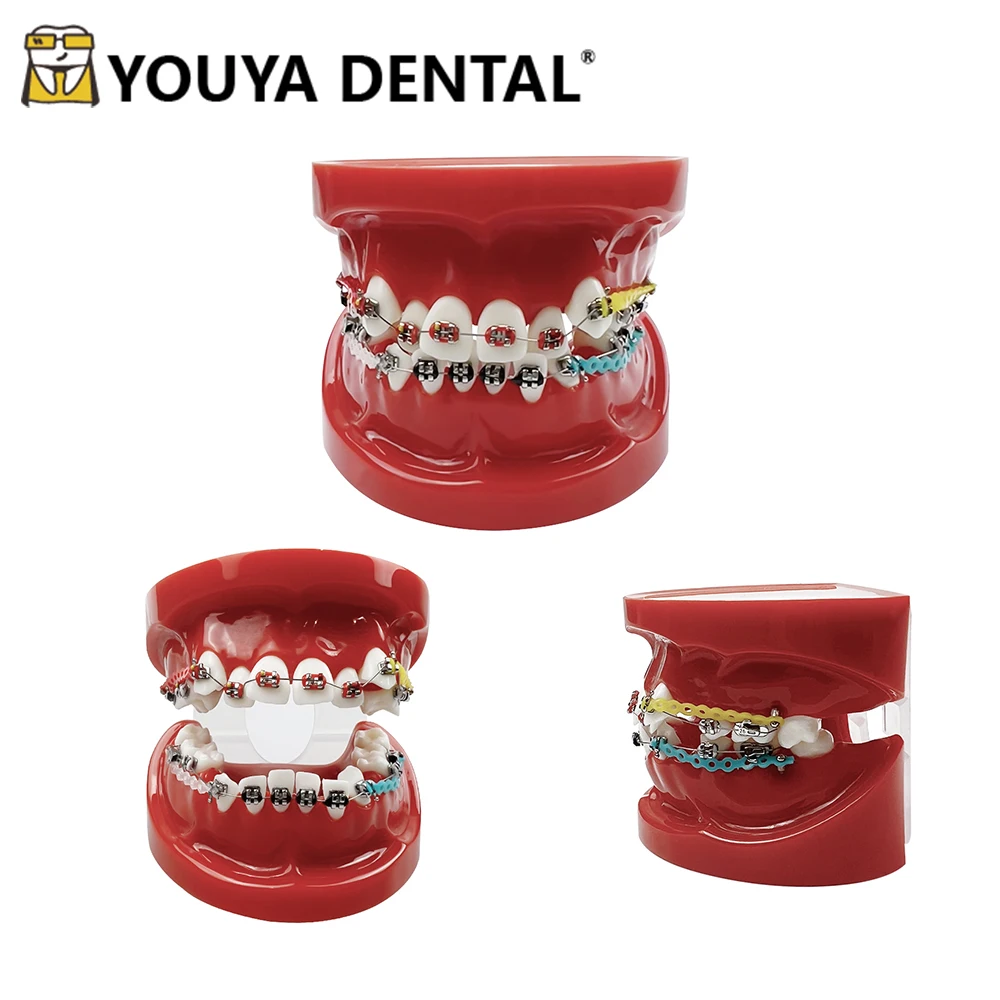 

Dental Orthodontic Treatment Teaching Model with Metal Bracket for Dental Technician Oral Practice Training Studying Model