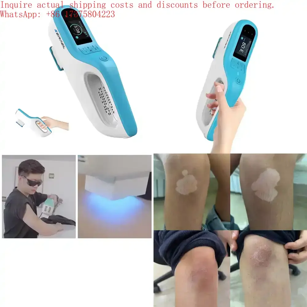 

Kernel KN-5000E Portable 308nm Excimer Therapy XeCl Monochromatic UVB for Localized Psoriasis Treatment