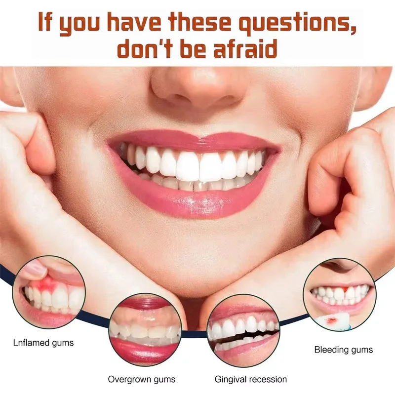 مصل اللثة سريع الإصلاح يخفف بشكل فعال من حساسية الأسنان وتسوس الأسنان وتنظيف معجون الأسنان وتخفيف قطرات تلف الأسنان gx&nfc #3