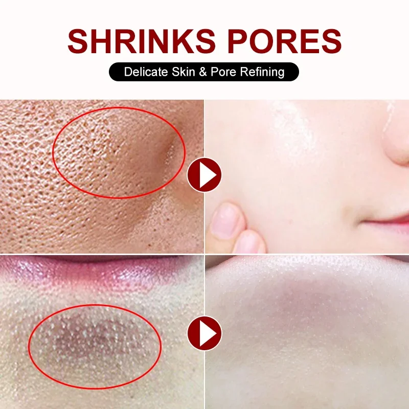 Crème de rétrécissement des pores à l'acide salicVAC, élimination rapide des grands pores, élimine les points noirs, resserre le visage, lisse la peau, produit de soin de beauté