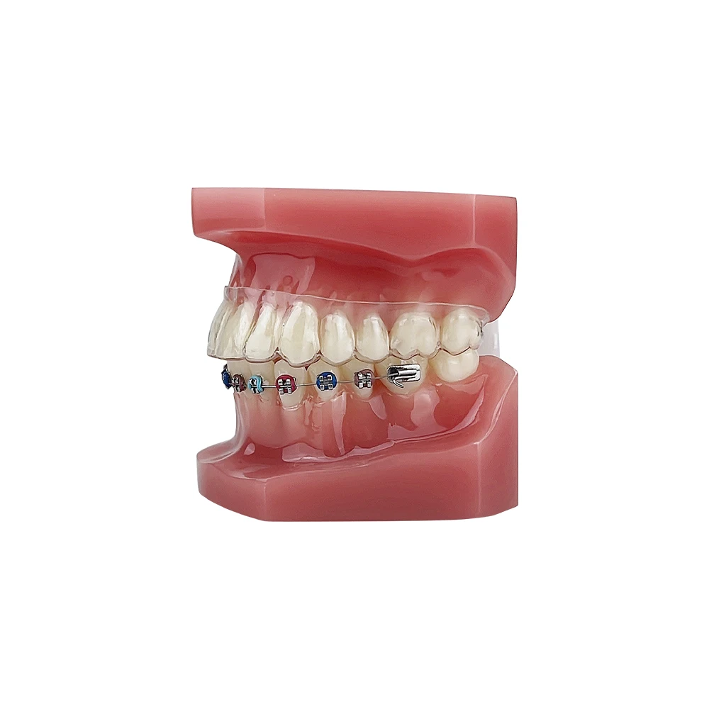 Orthodontic Model Teeth Clear Aligners Invisible Dental Orthodontic Teeth Model With Braces  For Studying Teaching Demonstration