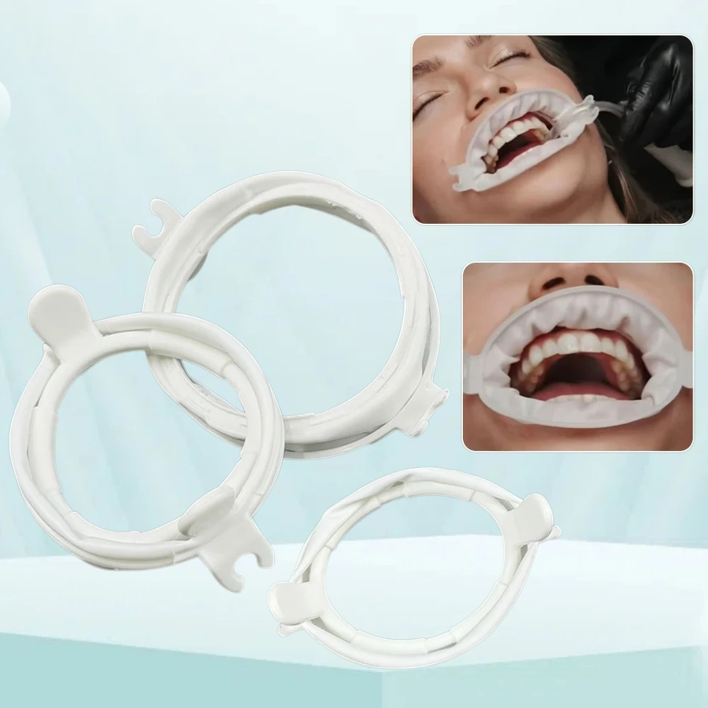 

S/m/l Soft Dental Lip Cheek Retractor O Shape Mouth Opener for Orthodontic Dentistry Disposable Tool