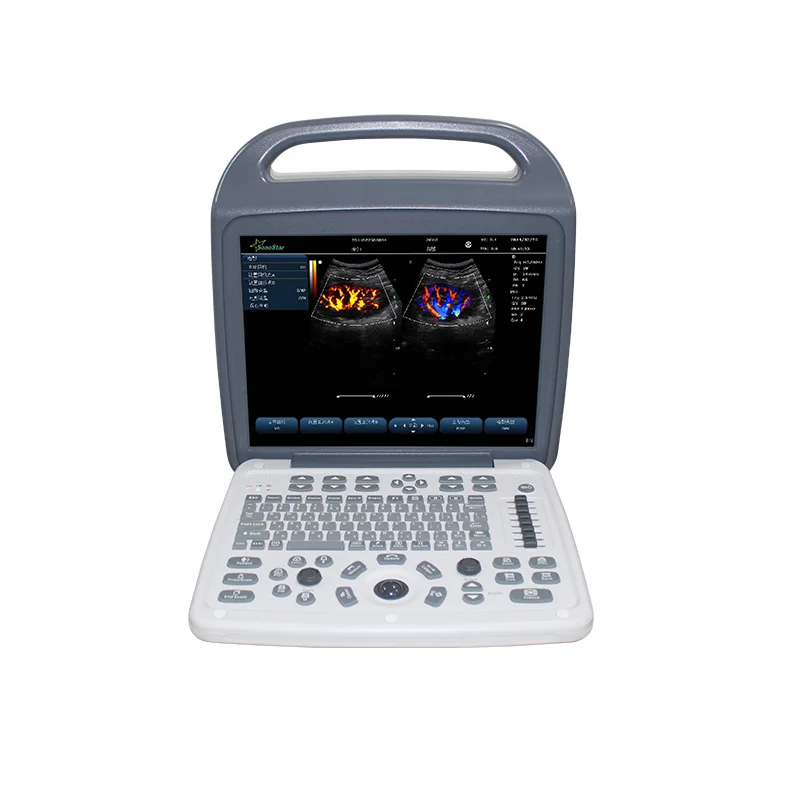 C10M 40 Channel Color Doppler Laptop Ultrasound Machine