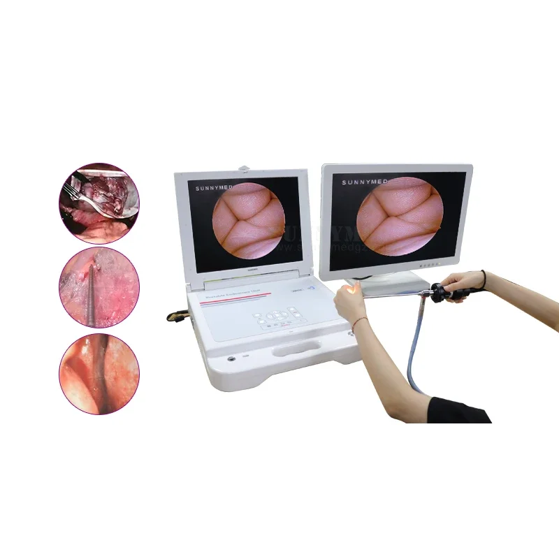 SY-PS045N good quality Hysteroscope Rigid Endoscope 3 in 1 instrument CCD endoscopy